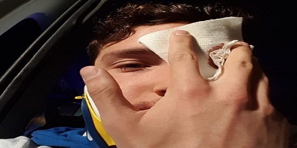 Pallanuoto, Matteo Aiello: brutto incidente, siamo stati fortunati a uscirne con qualche ferita